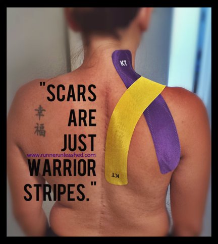 scars
