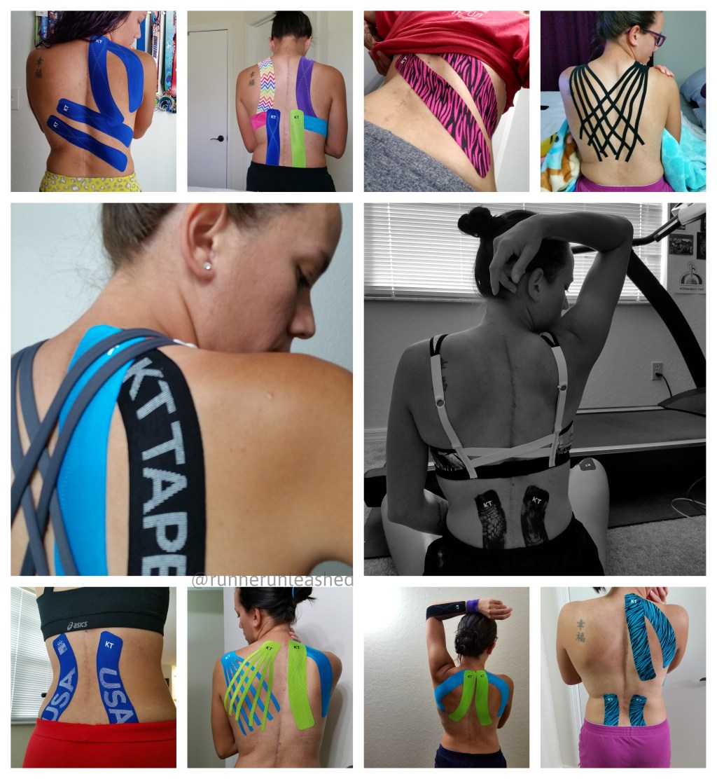 Pain control for&nbsp;Scoliosis