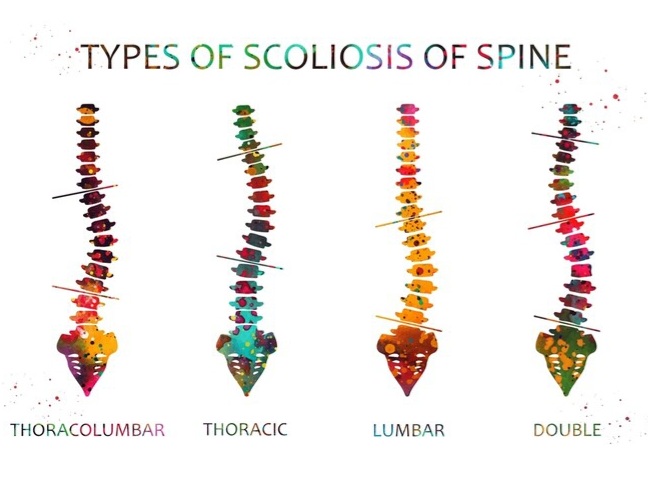 fposter,medium,wall_texture,product,750x1000